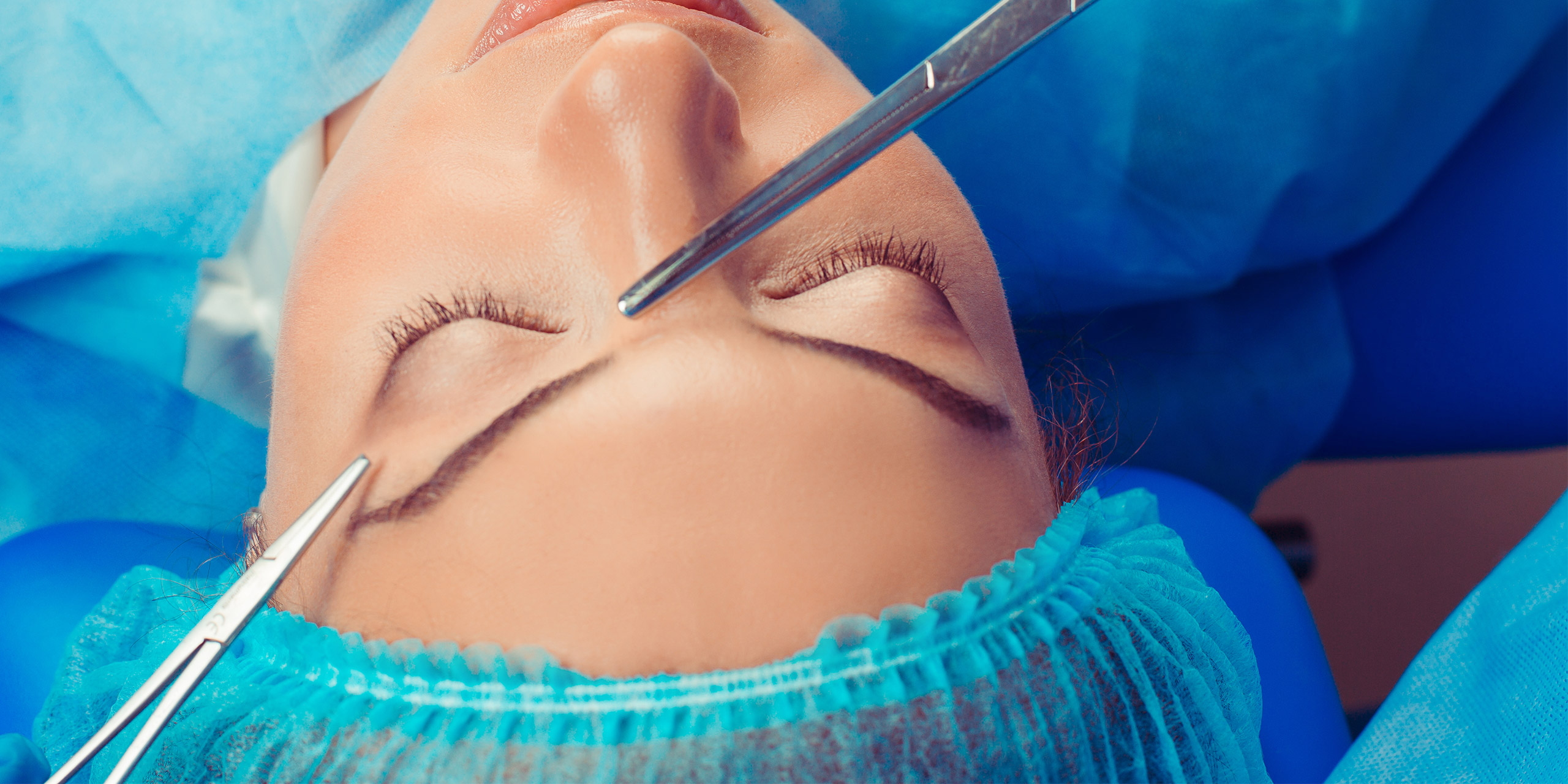 blefaroplastia